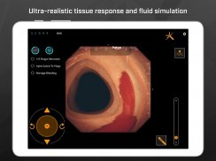 Gastro Ex: Played by Gastroent screenshot 1