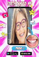 Braces Teeth  Photo Editor screenshot 1