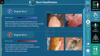 3D Ped Burn Resuscitation screenshot 5