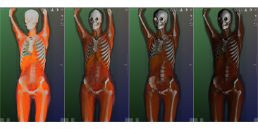 DroidRender - 3D DICOM viewer screenshot 13