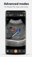 Clarius Ultrasound App screenshot 3