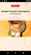 Benign Prostatic Hyperplasia screenshot 5