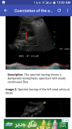 Ultrasound Guide A2Z screenshot 4