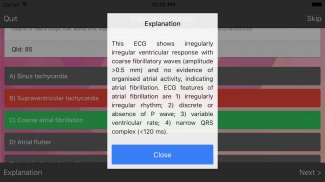 ECG Master: Quiz & Explanation screenshot 3