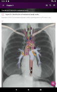 Chest X-Ray DEMO screenshot 15