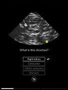Deepscope Ultrasound Simulator screenshot 6