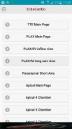 EchoCardio screenshot 5