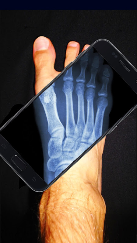 X-Ray Scanner - Скачать для Android APK бесплатно