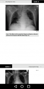 Medical X-Ray Interpretation with 100+ Cases screenshot 5