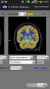 3-D brain Atlas screenshot 3