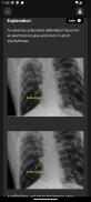 Basic Radiology screenshot 4