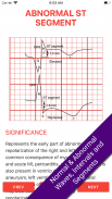 ECG FlashCards 2 Lite - Free Reference EKG App screenshot 7