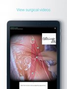 Touch Surgery: Surgical Videos screenshot 8