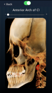 Dental Panoramic Radiology screenshot 3