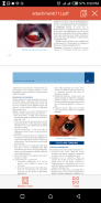 Ophthalmology Review - Comprehensive Ophthalmology screenshot 3