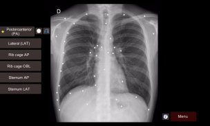 Radiographic Anatomy X-Ray screenshot 6