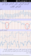 تشخيص القلب (معدل ضربات القلب، انتظام ضربات القلب) screenshot 0