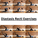 Diastasis Recti Exercises