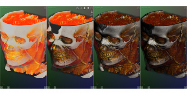 DroidRender - 3D DICOM viewer screenshot 14