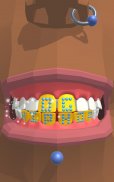 Dentist Bling screenshot 1