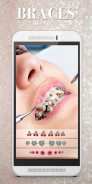 Braces Photo Editor - Beauty editor screenshot 1