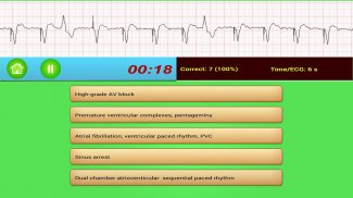 ECG Rhythm screenshot 3