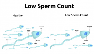 Increase Your Sperm Count screenshot 0