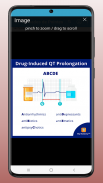 ECG EKG Interpretation Mastery screenshot 7