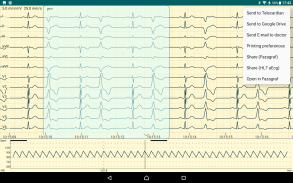 DiaCard - ECG Recorder screenshot 3