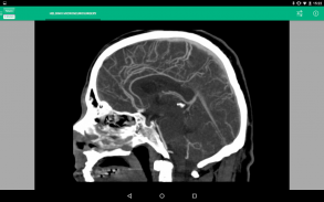 Helsinki Microneurosurgery screenshot 2