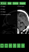 Radiology CT Viewer screenshot 3
