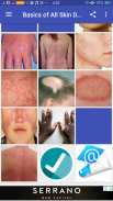 Basics of All Skin Diseases screenshot 0