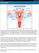 Uterine Fibroid Treatment Help screenshot 6