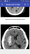 CT Brain Interpretation screenshot 7