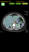 Radiology CT Anatomy screenshot 0