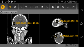 Symmetry DICOM screenshot 14