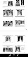 Medical X-Ray Interpretation with 100+ Cases screenshot 0