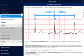 ECG APPtitude screenshot 2