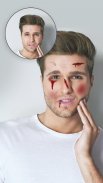 Injury on Face Photo Maker screenshot 0