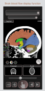 CT PassportLite Head/Brain MRI sectional anatomy screenshot 3