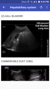 Abdomino-Pelvic Ultrasound Guide screenshot 3