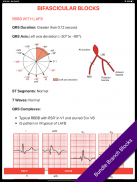 ECG FlashCards 2 Lite - Free Reference EKG App screenshot 1