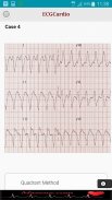 ECGCardio screenshot 6