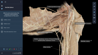 cadaVR anatomy screenshot 10