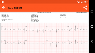 Spaulding ECG screenshot 0