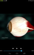 Ophthalmology -Pocket Dict. screenshot 10