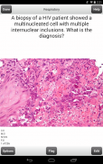 USMLE Step 2 CK Cards Lite screenshot 14