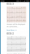 Diagnose ECG screenshot 1