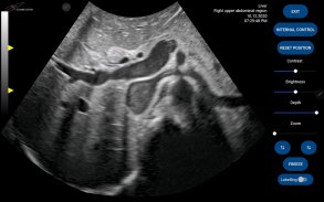 Scanbooster Ultrasound Sim screenshot 6