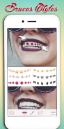 Braces Photo Editor screenshot 2